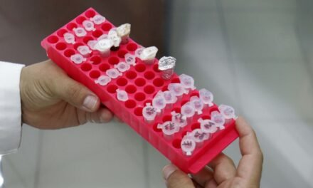 EL TIPO DE ALIMENTACIÓN ES DETERMINANTE EN LA APARICIÓN DE CÁLCULOS RENALES: ESPECIALISTAS EN MEDICINA Y NUTRICIÓN