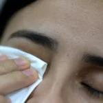 EL INVIERNO ES LA ÉPOCA MÁS PROBLEMÁTICA PARA LA VISTA