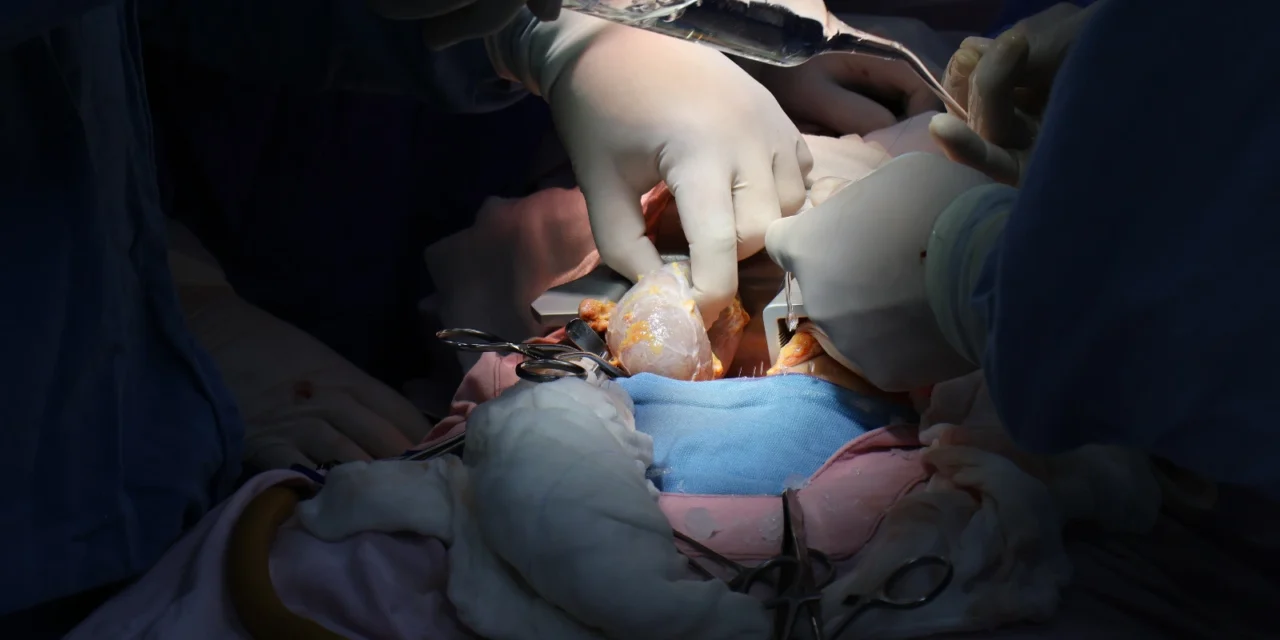 LOGRA IMSS SINALOA DOS TRASPLANTES RENALES CON APOYO DE MISIÓN AÉREA