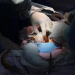 LOGRA IMSS SINALOA DOS TRASPLANTES RENALES CON APOYO DE MISIÓN AÉREA